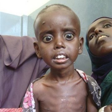 بحران غذایی 6 میلیون کودک را در اتیوپی تهدید می کند